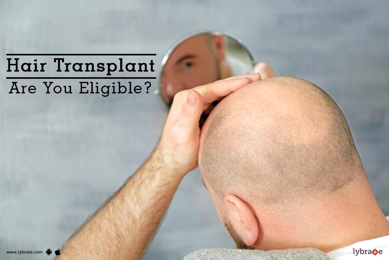 Hair Transplant - Are You Eligible?