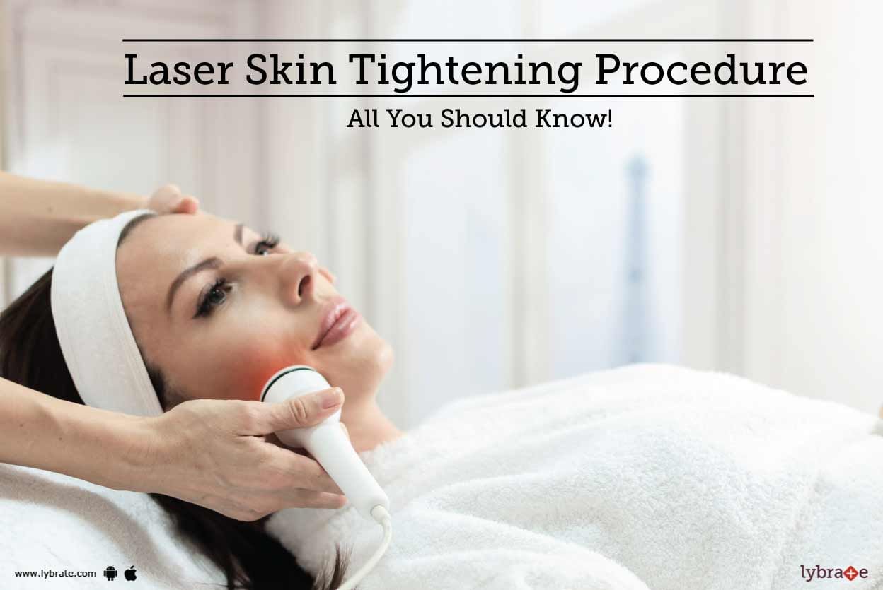 Laser Skin Tightening Procedure - All You Should Know!