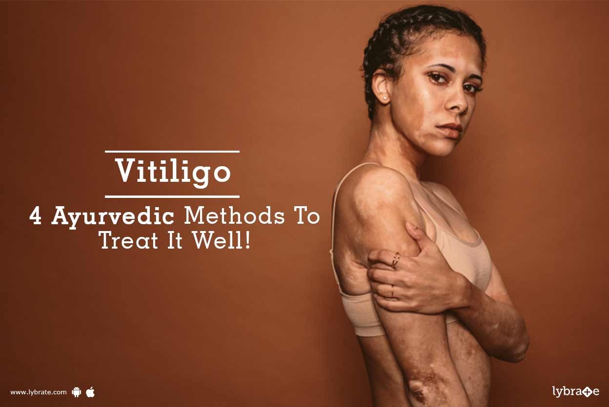 Vitiligo - 4 Ayurvedic Methods To Treat It Well!