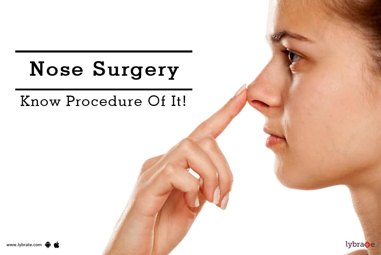 Nose Surgery - Know Procedure Of It!