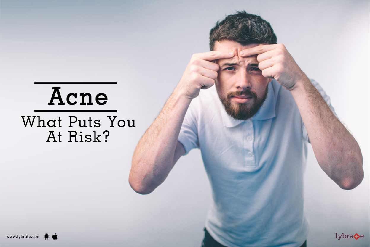 Acne - What Puts You At Risk?