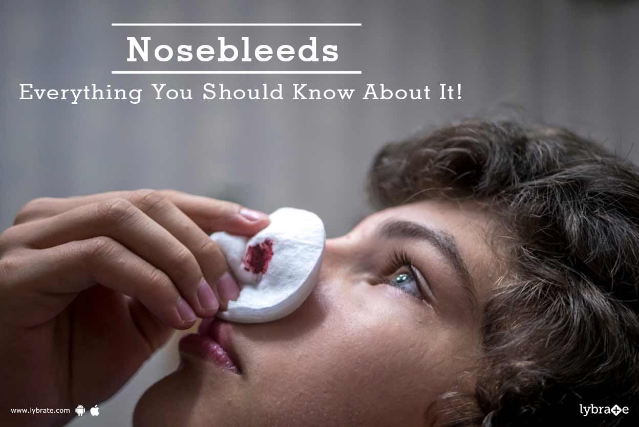 Nosebleeds - Everything You Should Know About It!