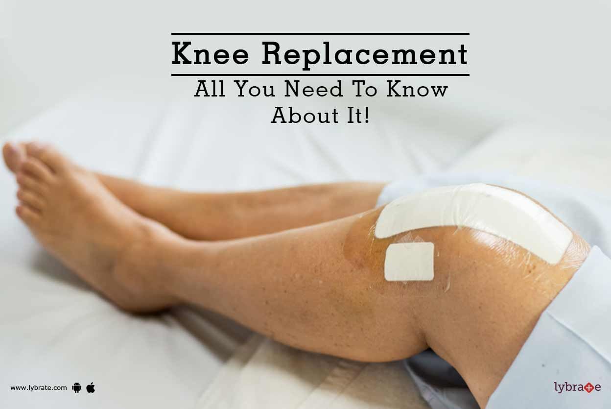 Knee Replacement - All You Need To Know About It!