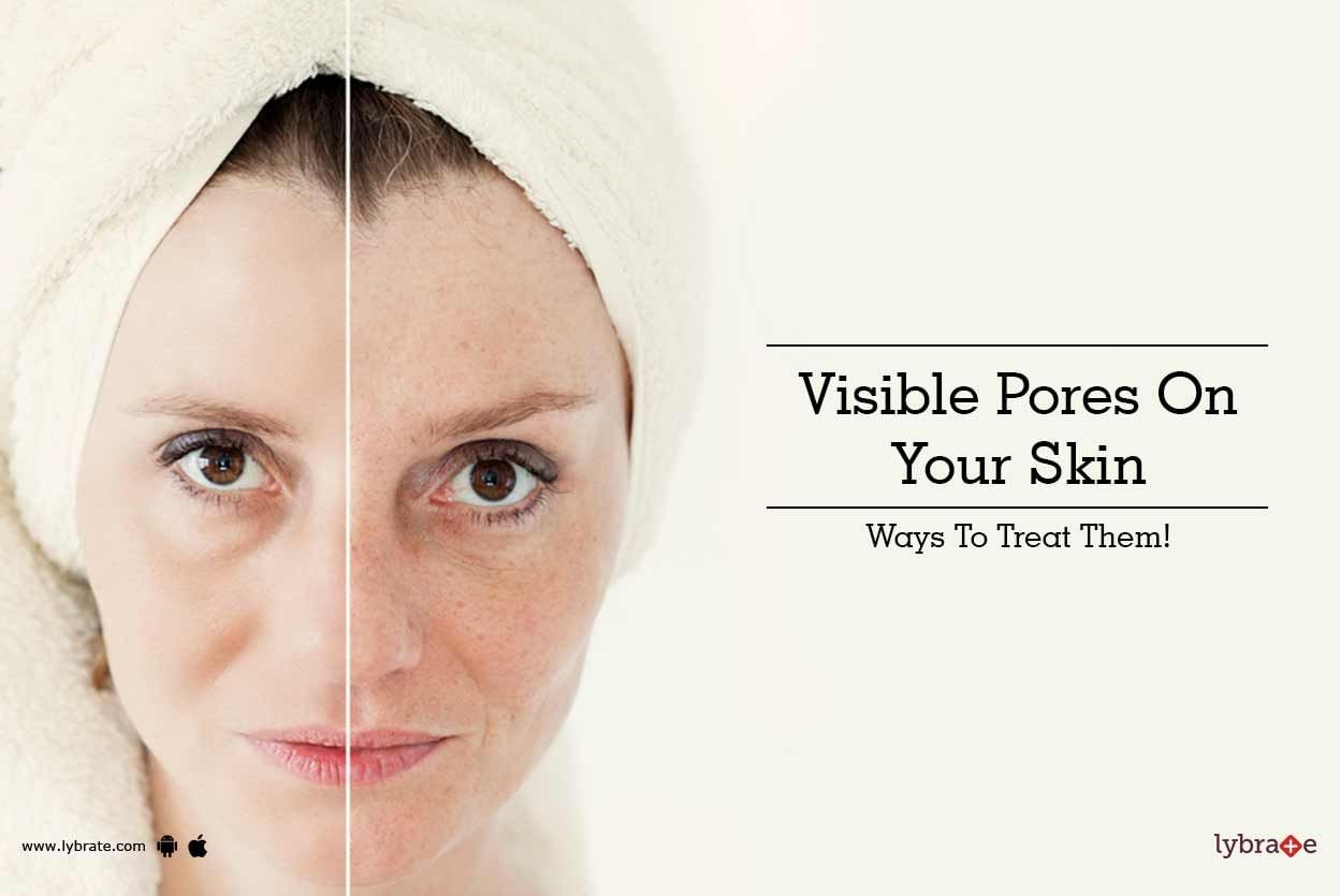 Visible Pores On Your Skin - Ways To Treat Them!
