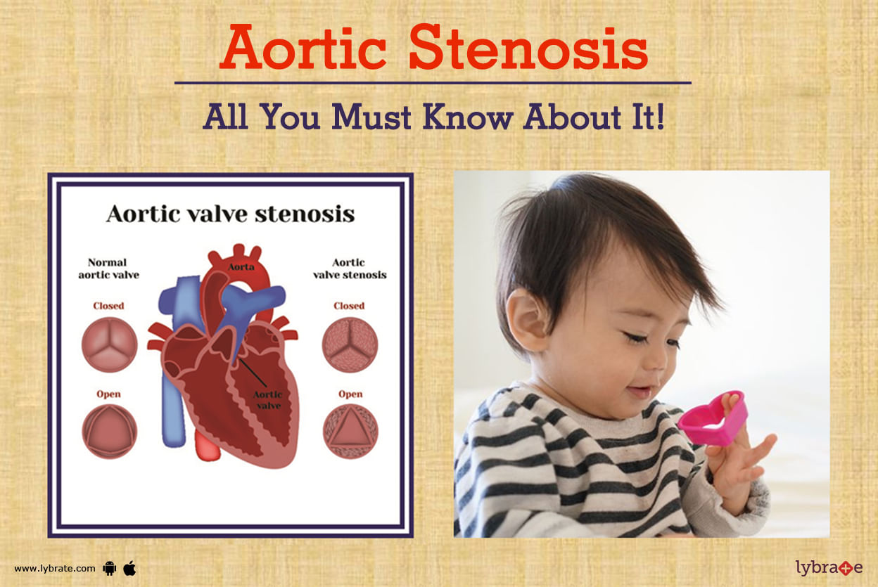 Aortic Stenosis - All You Must Know About It!