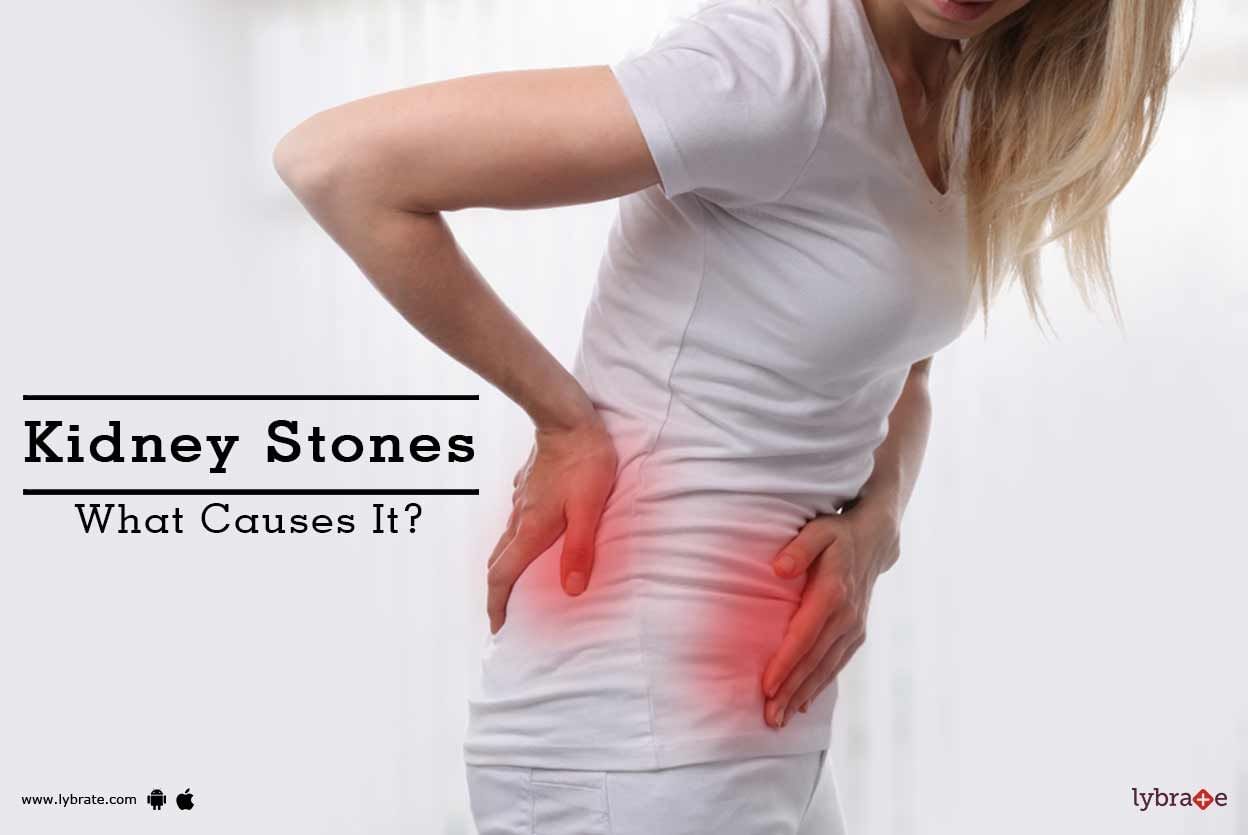 Kidney Stones - What Causes It?