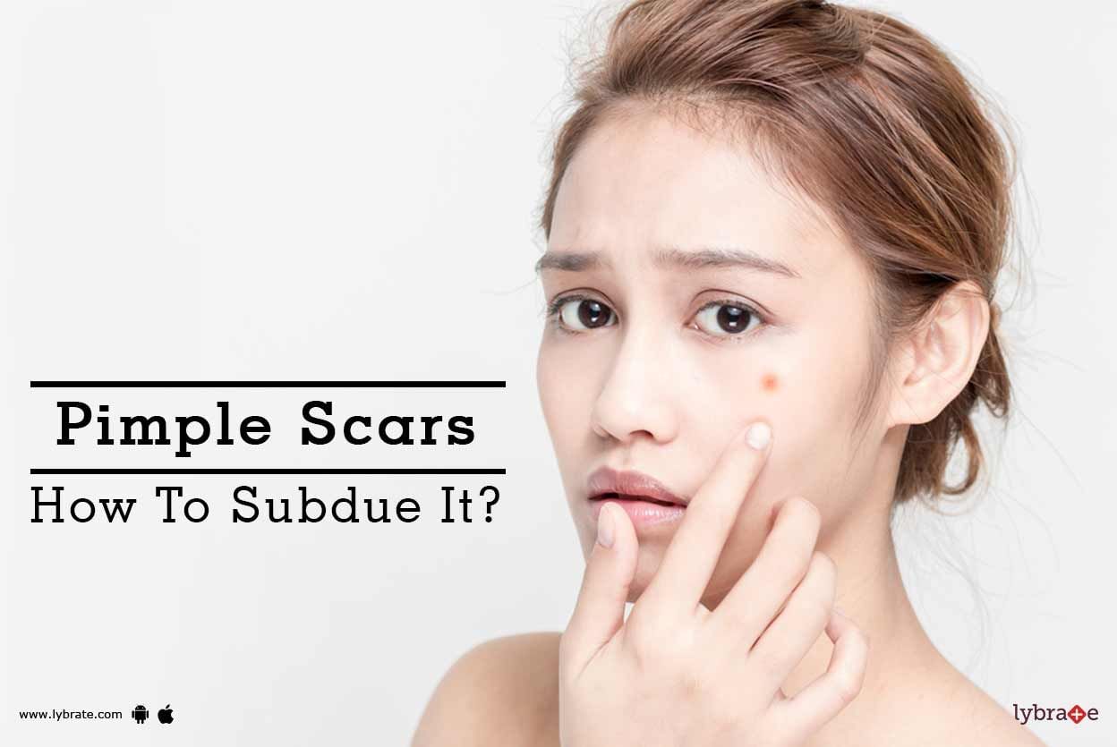 Pimple Scars - How To Subdue It?