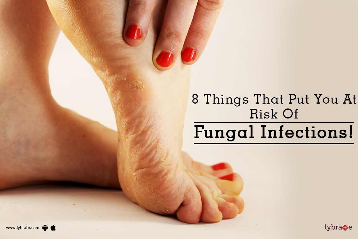 8 Things That Put You At Risk Of Fungal Infections!