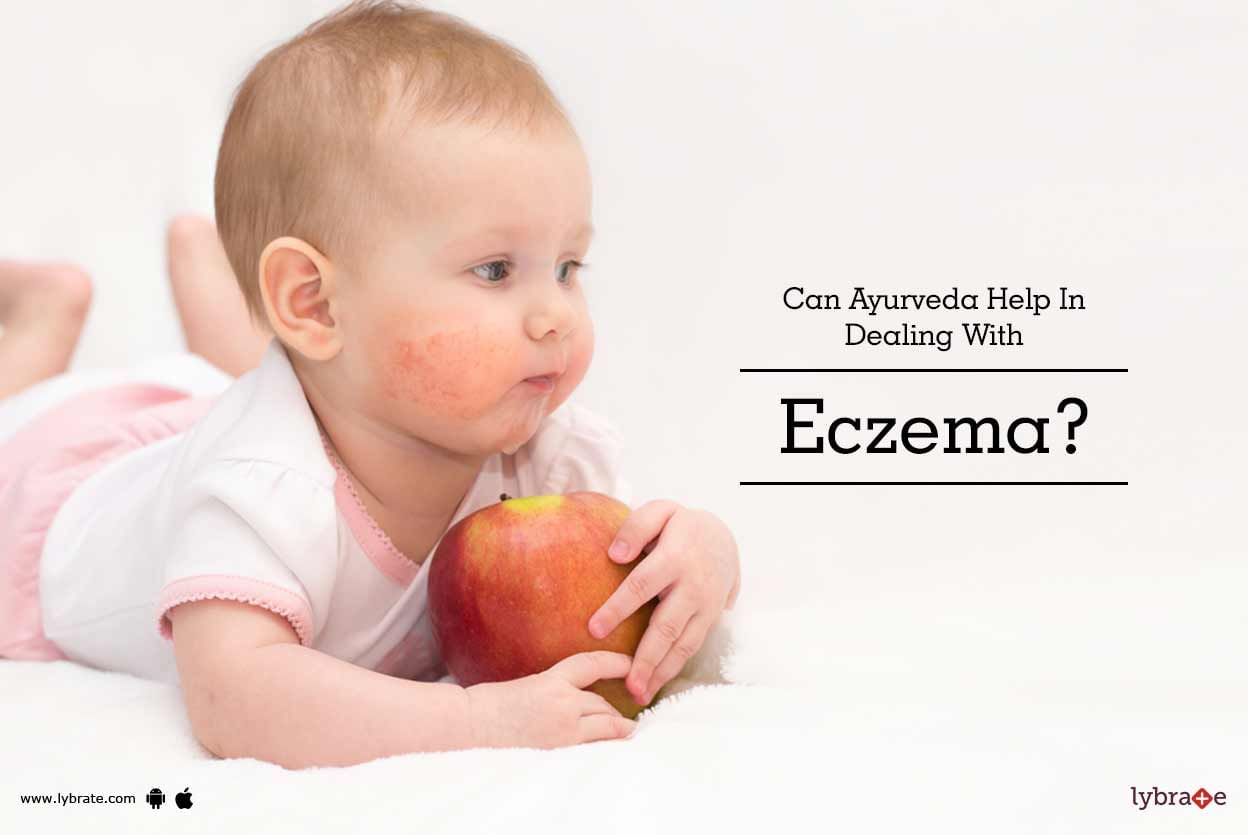 Can Ayurveda Help In Dealing With Eczema?