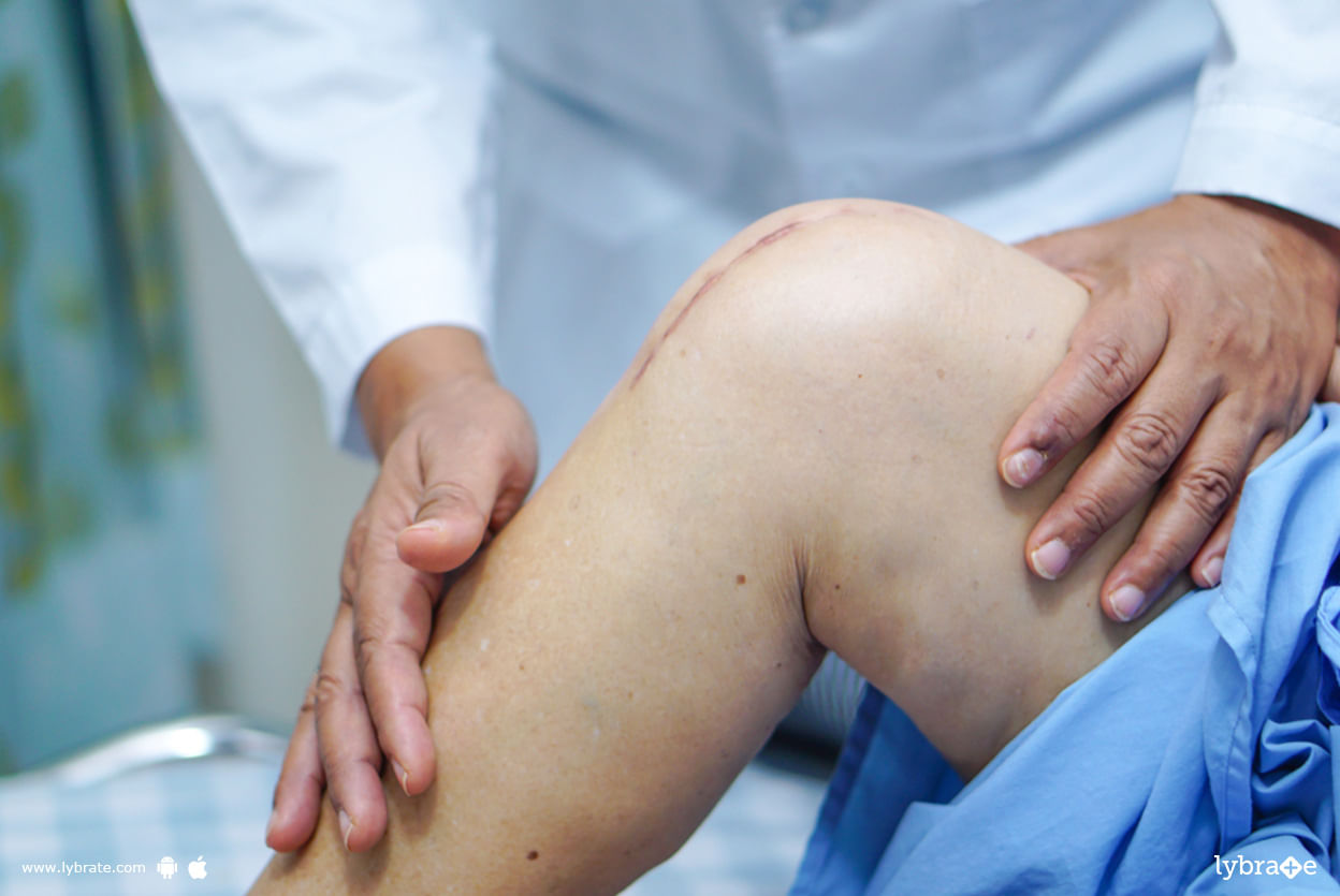 ACL Reconstruction - Know Procedure Of It!