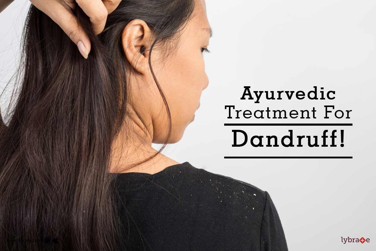 Ayurvedic Treatment For Dandruff!