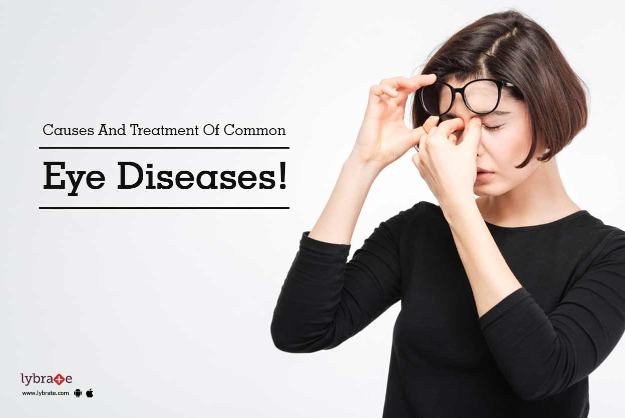 Causes And Treatment Of Common Eye Diseases!
