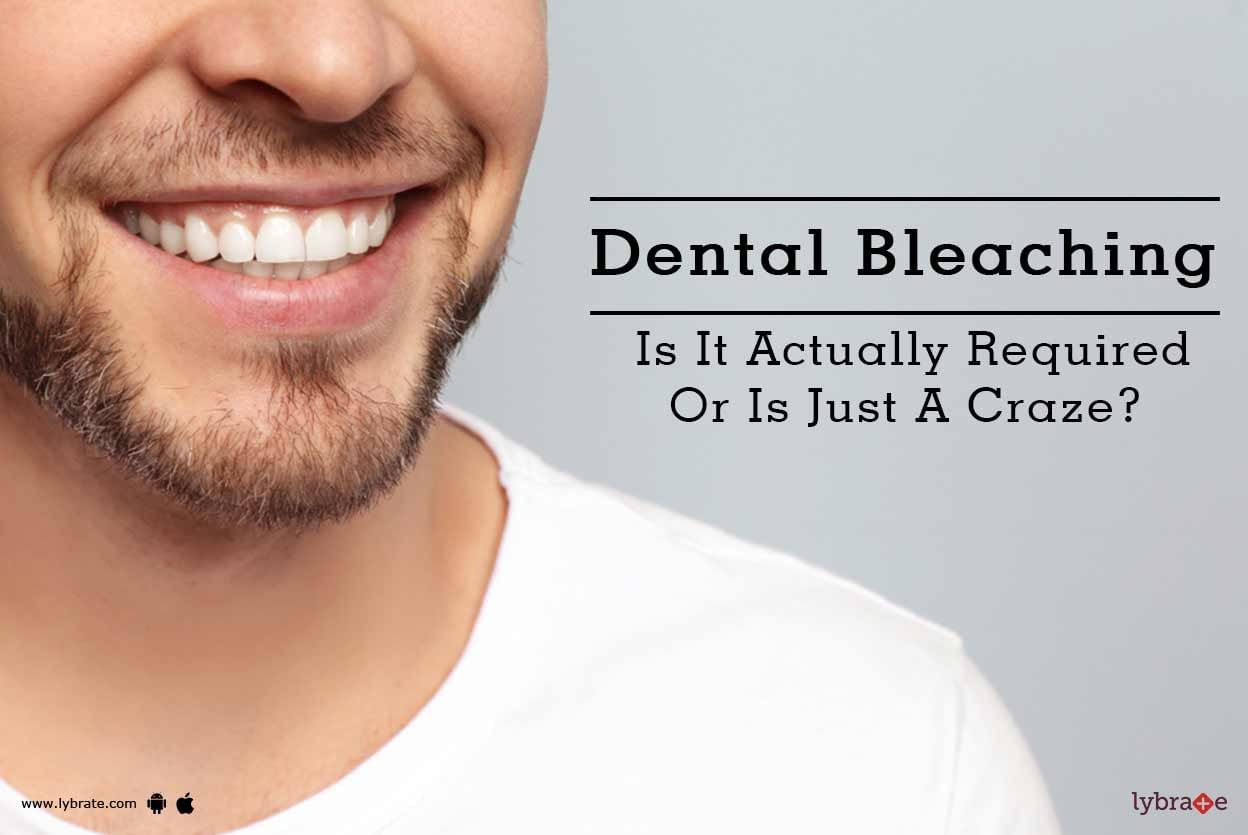 Dental Bleaching - Is It Actually Required Or Is Just A Craze?