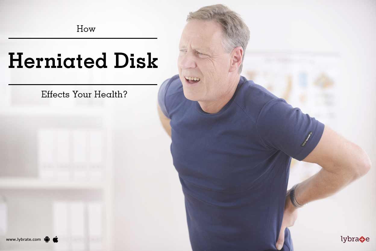 Know How Herniated Disc Affects Your Health!