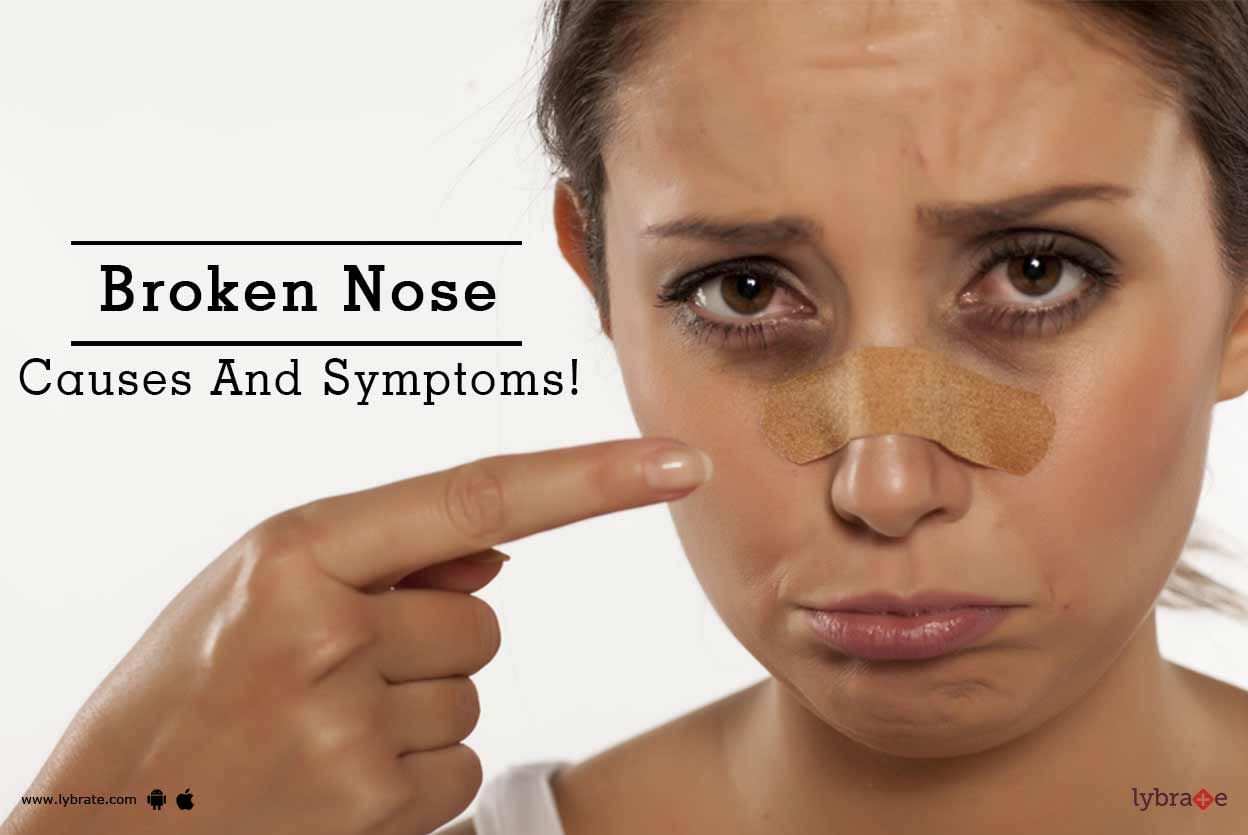 Broken Nose - Causes And Symptoms!