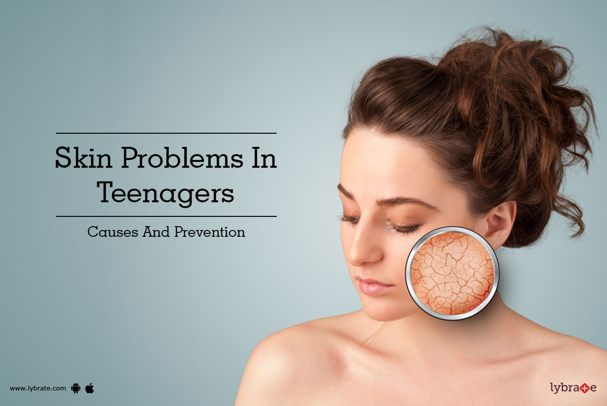 Skin Problems In Teenagers - Causes And Prevention