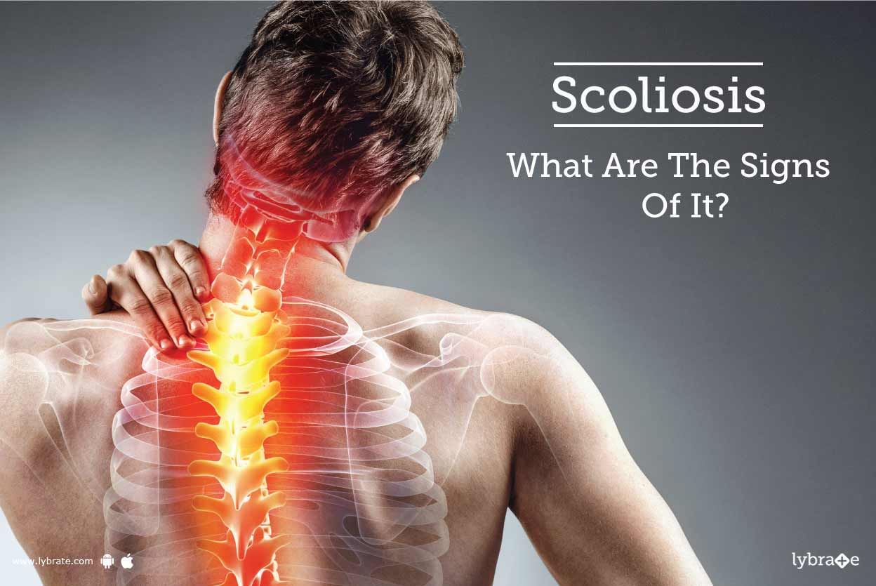 Scoliosis - What Are The Signs Of It?
