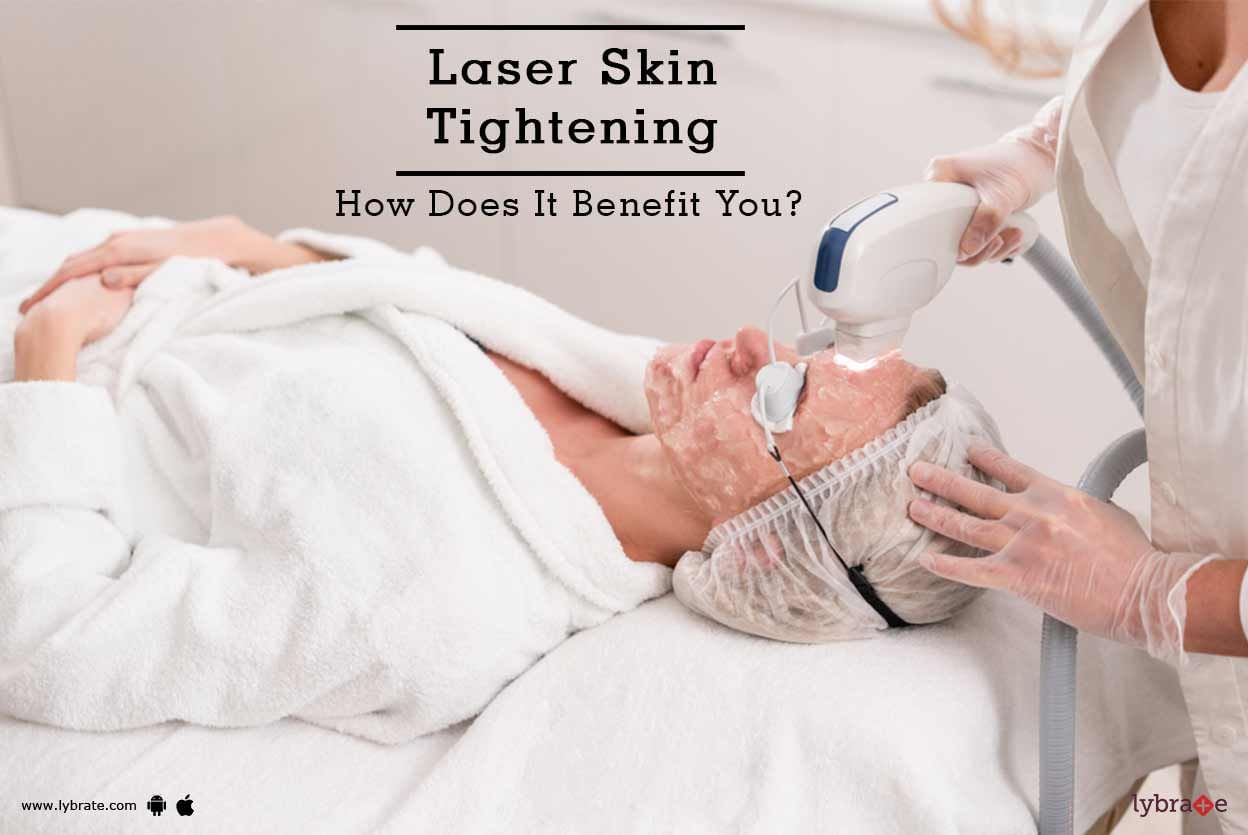 Laser Skin Tightening - How Does It Benefit You?