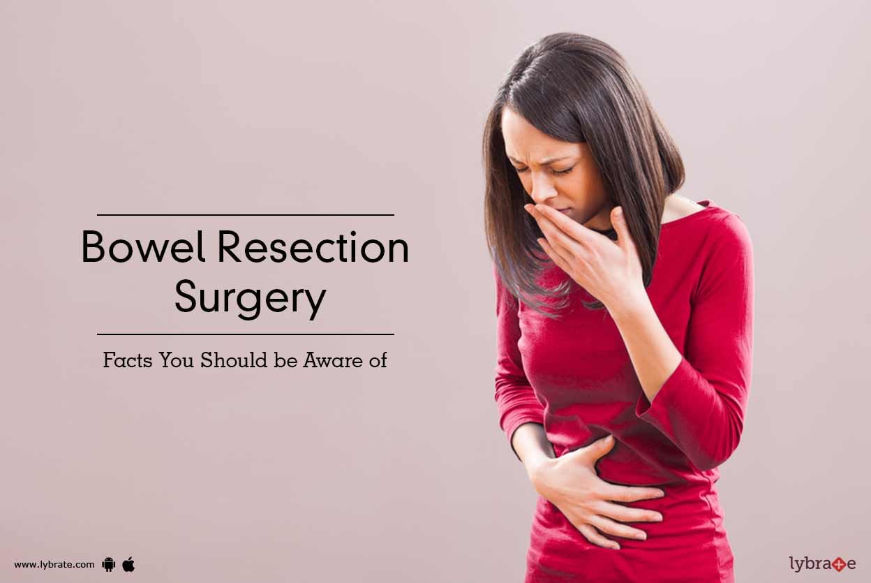 Bowel Resection Surgery - Facts You Should be Aware of