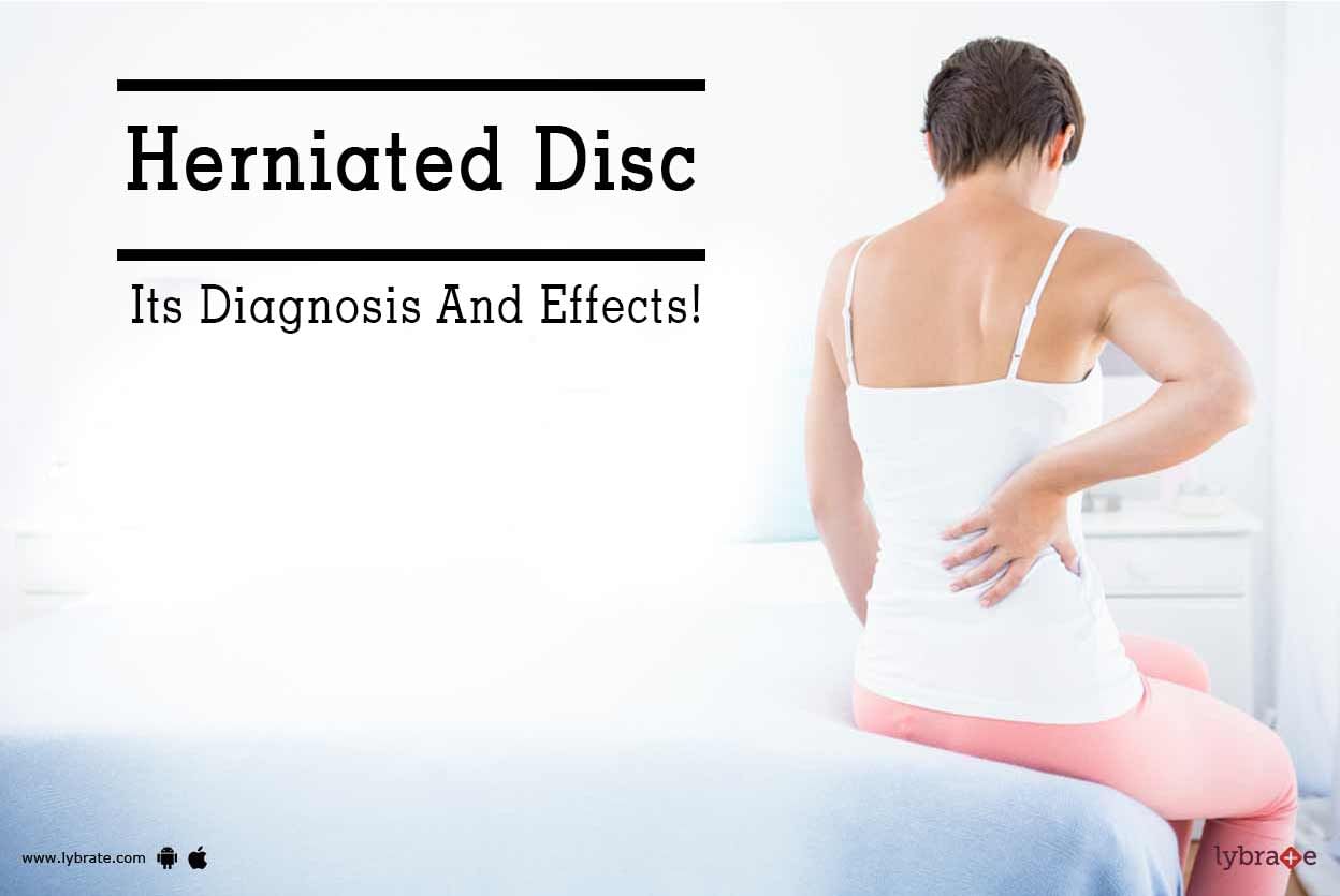Herniated Disc - Its Diagnosis And Effects!