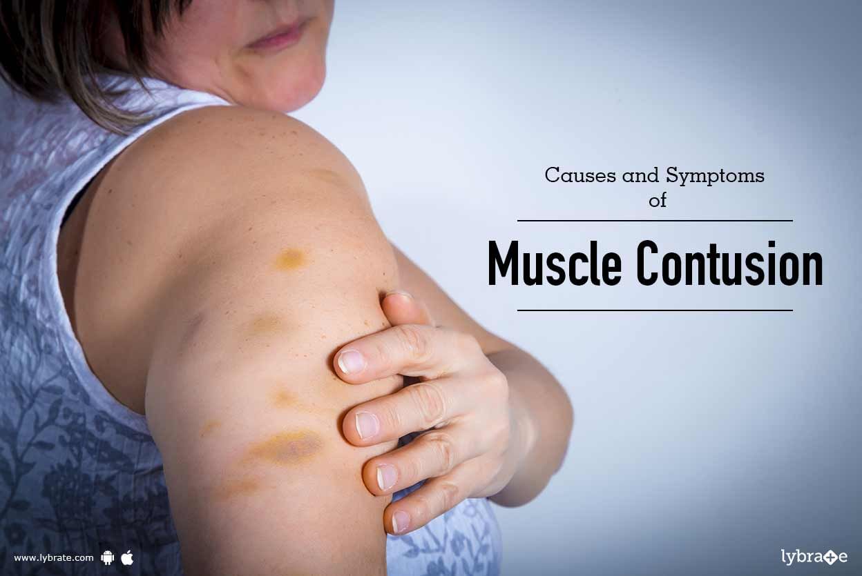 Causes and Symptoms of Muscle Contusion