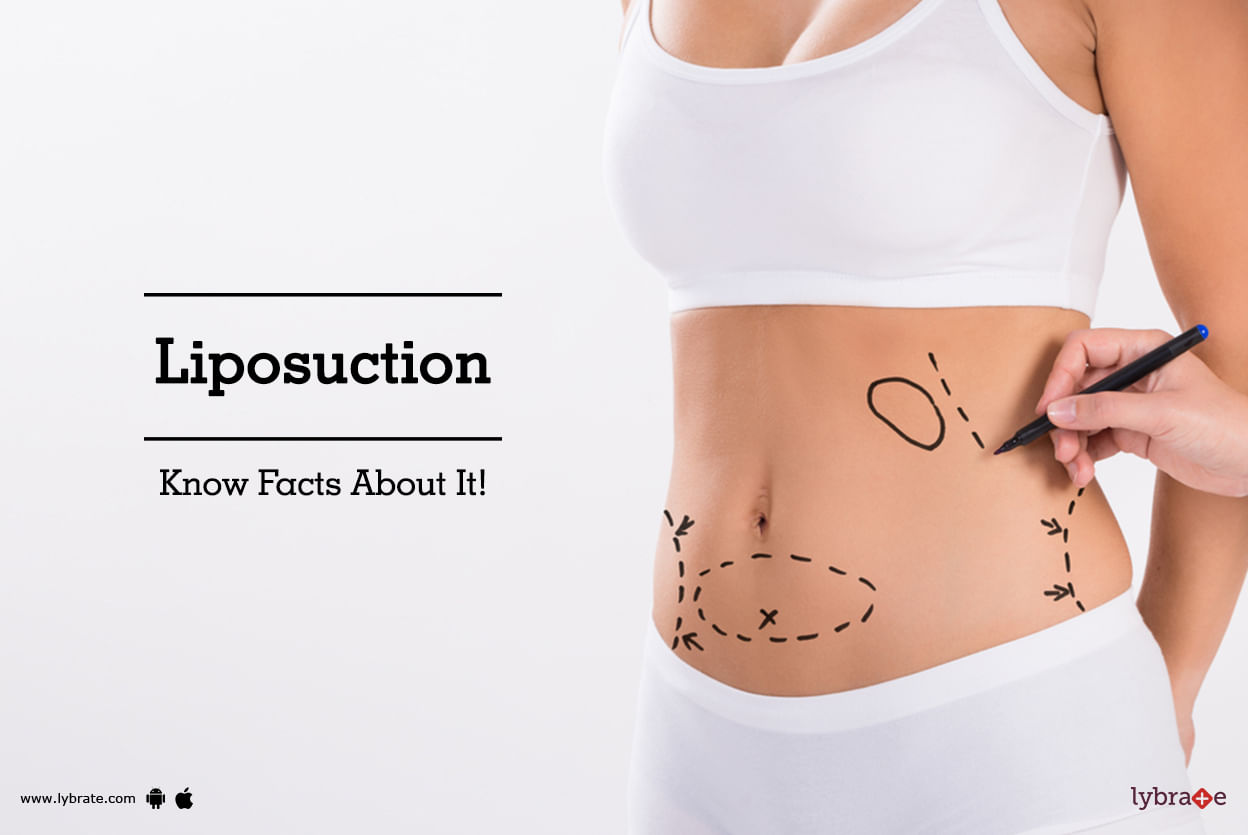 Liposuction - Know Facts About It!