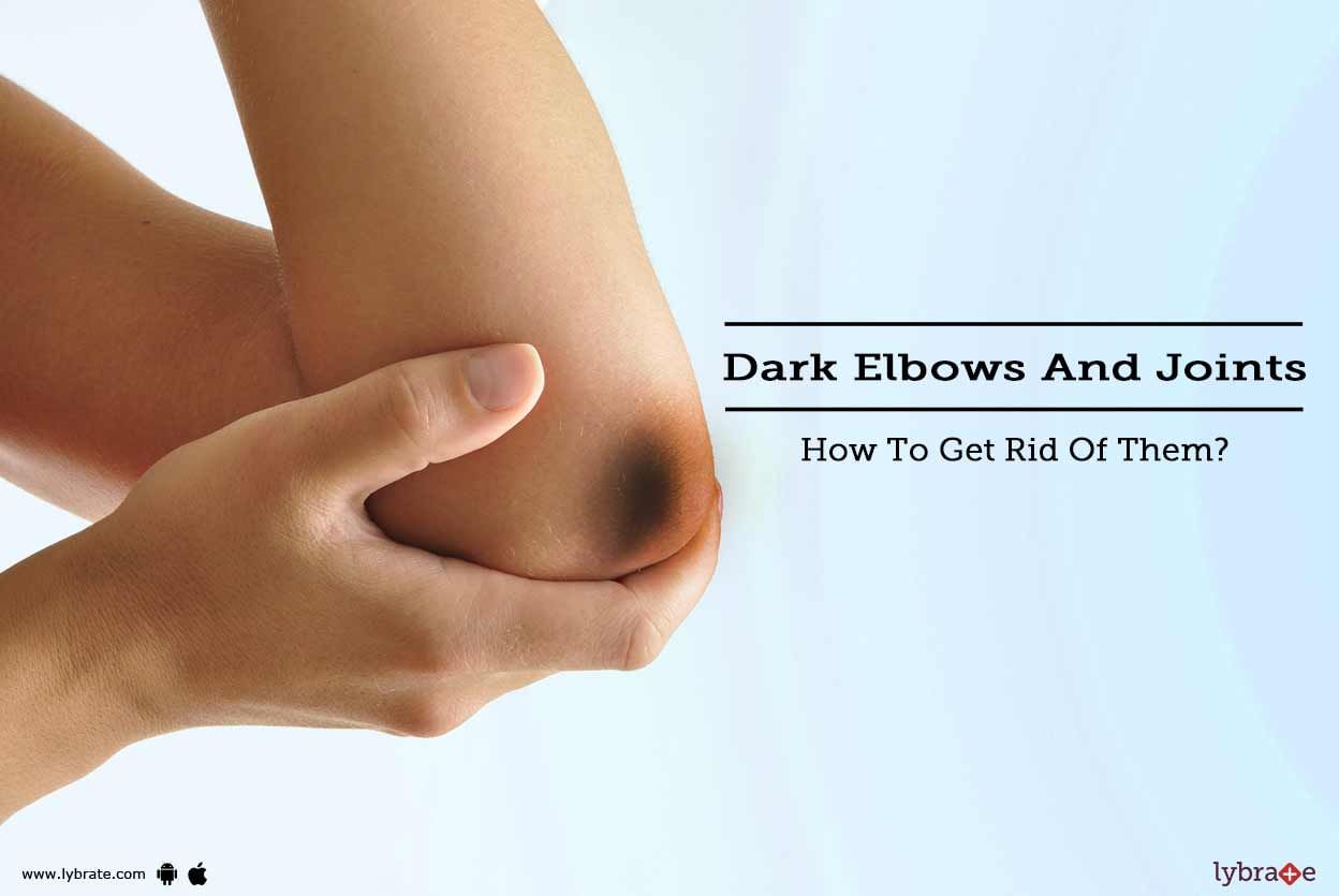 Dark Elbows And Joints - How To Get Rid Of Them?