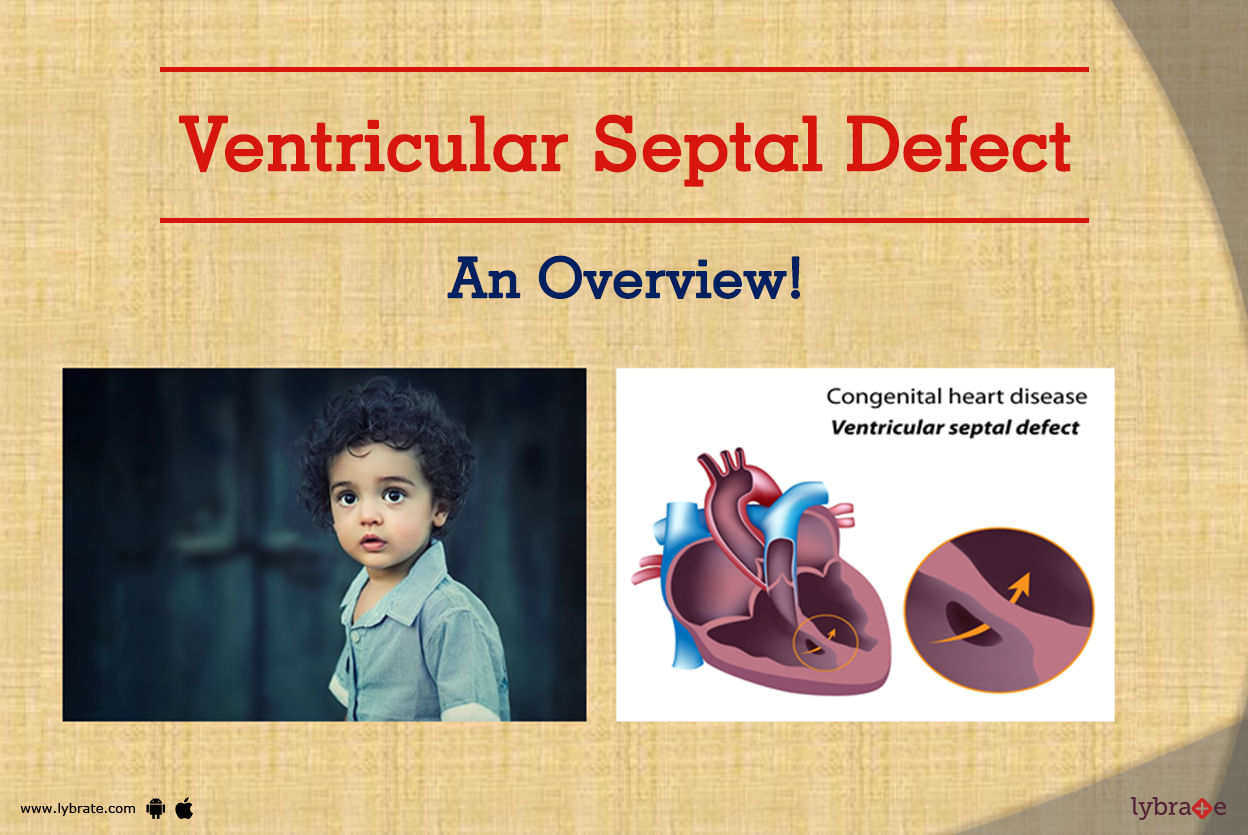 Ventricular Septal Defect - An Overview!