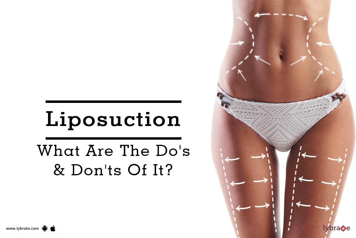 Liposuction - What Are The Do's & Don'ts Of It?
