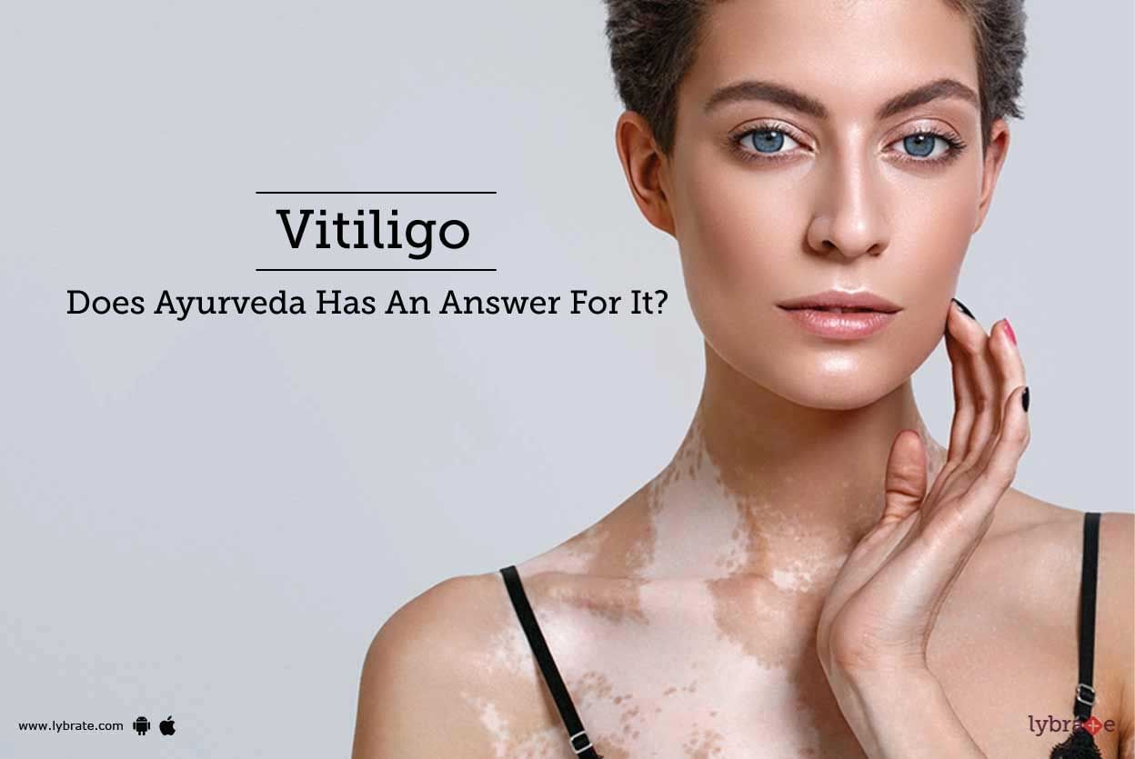 Vitiligo - Does Ayurveda Has An Answer For It?