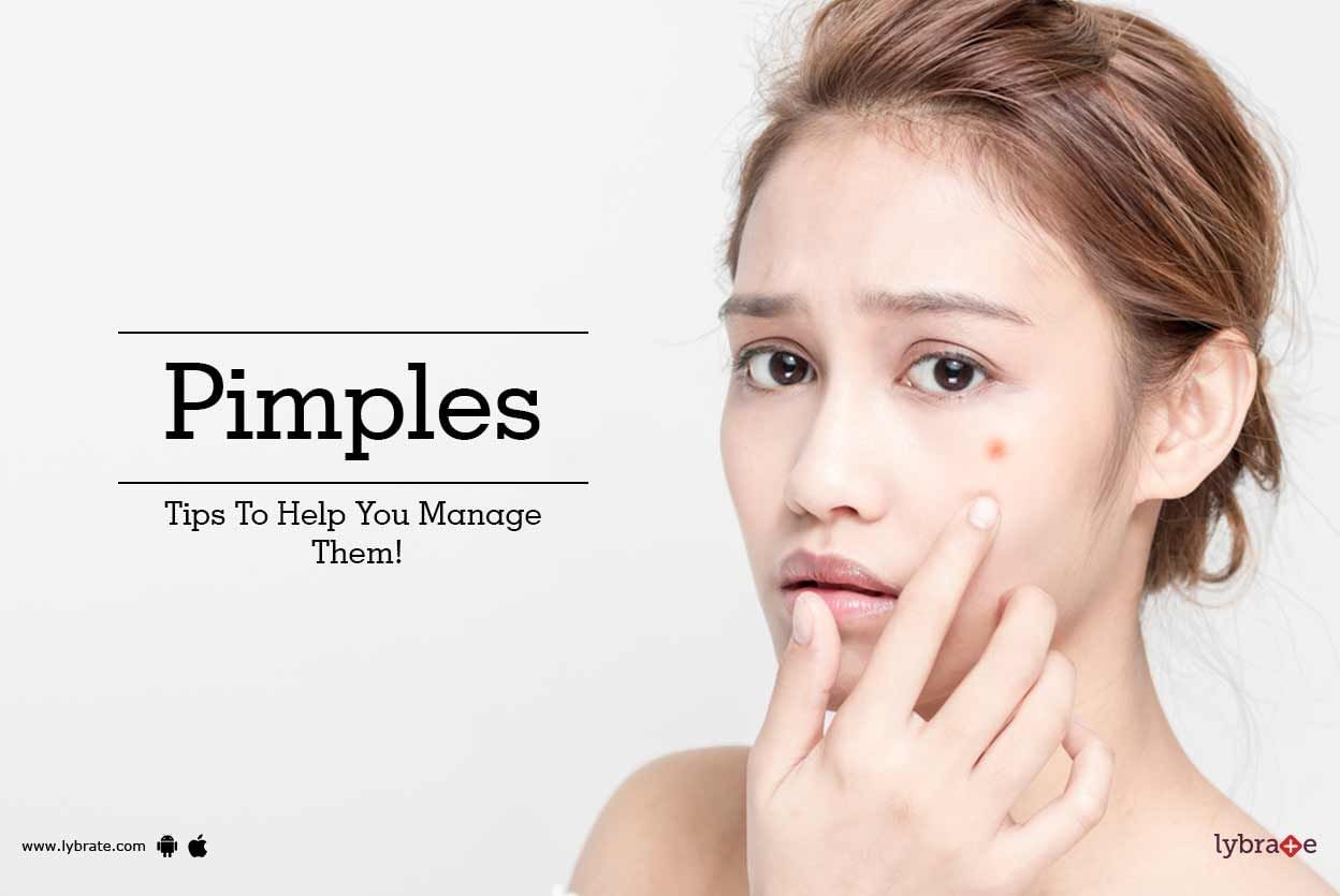 Pimples - Tips To Help You Manage Them!