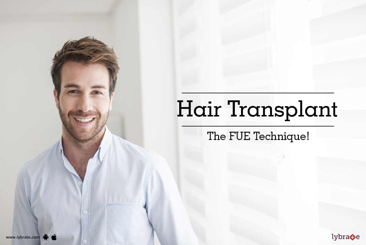 Hair Transplant - The FUE Technique!