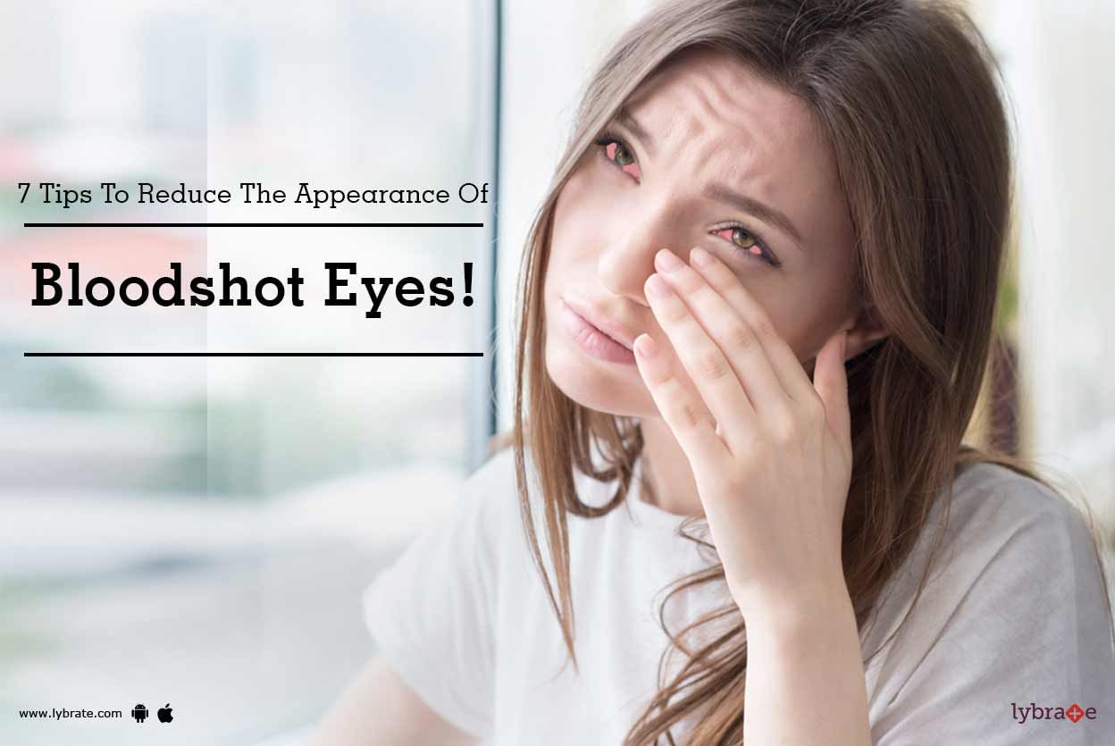 7 Tips To Reduce The Appearance Of Bloodshot Eyes!