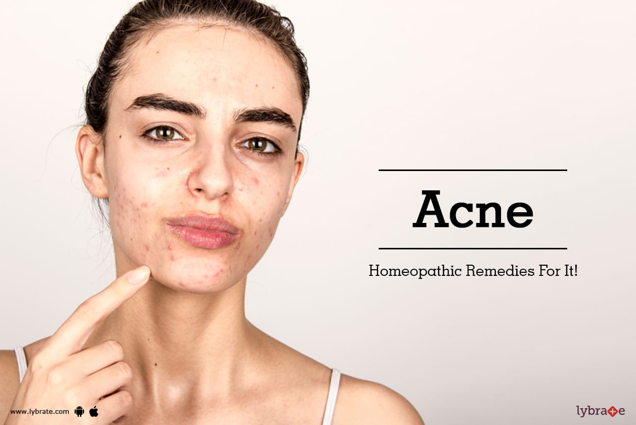 Acne - Homeopathic Remedies For It!