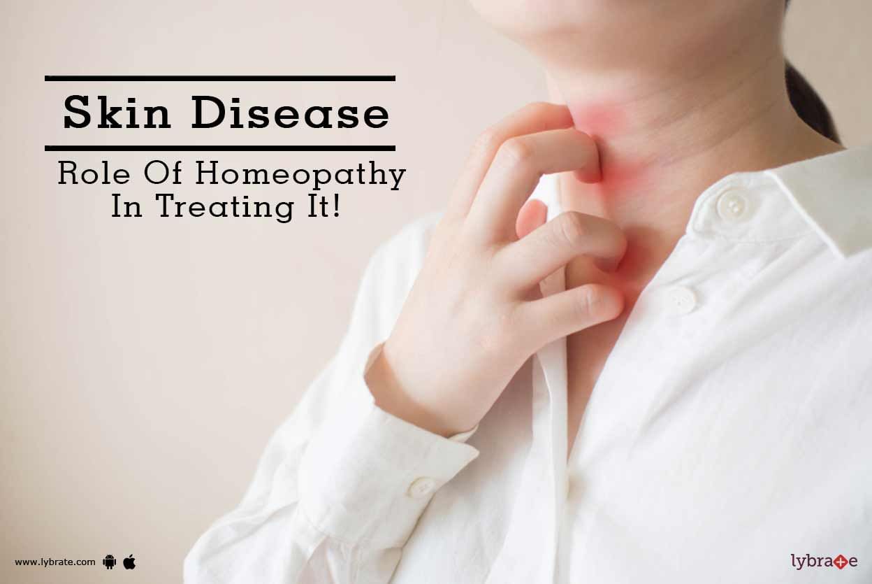 Skin Disease - Role Of Homeopathy In Treating It!