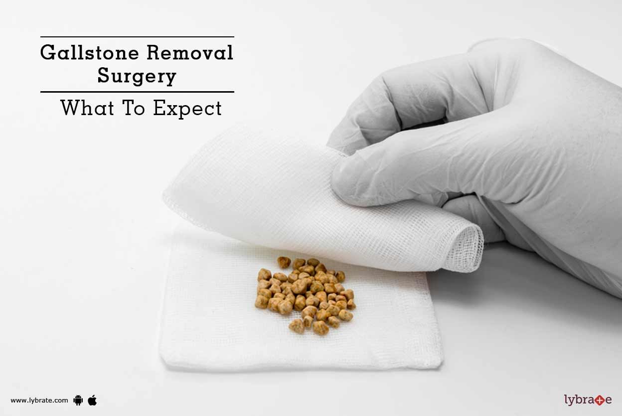 Gallstone Removal Surgery - What To Expect