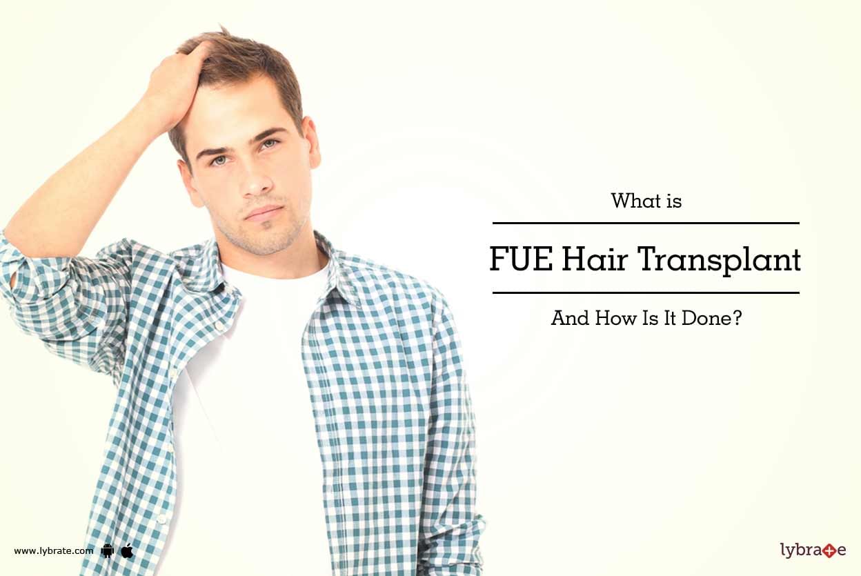What is FUE Hair transplant And How Is It Done?