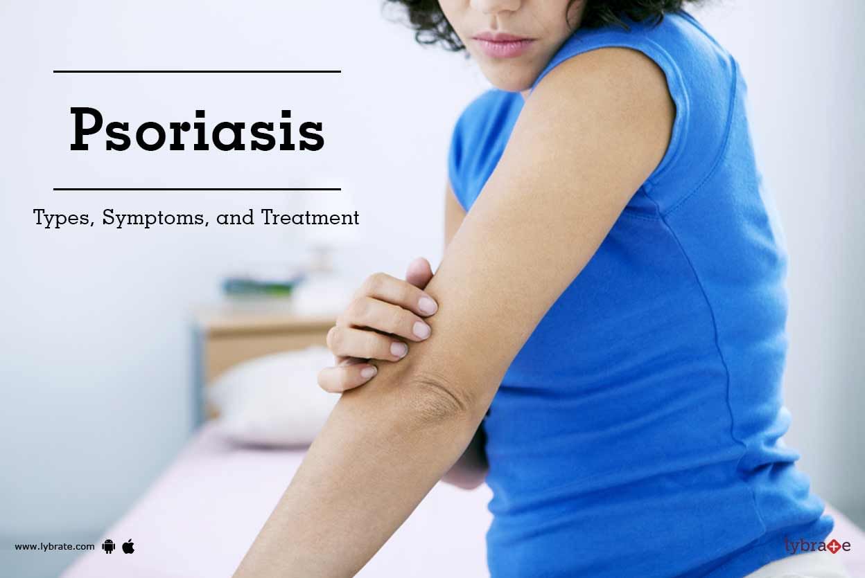 Psoriasis - Types, Symptoms, and Treatment
