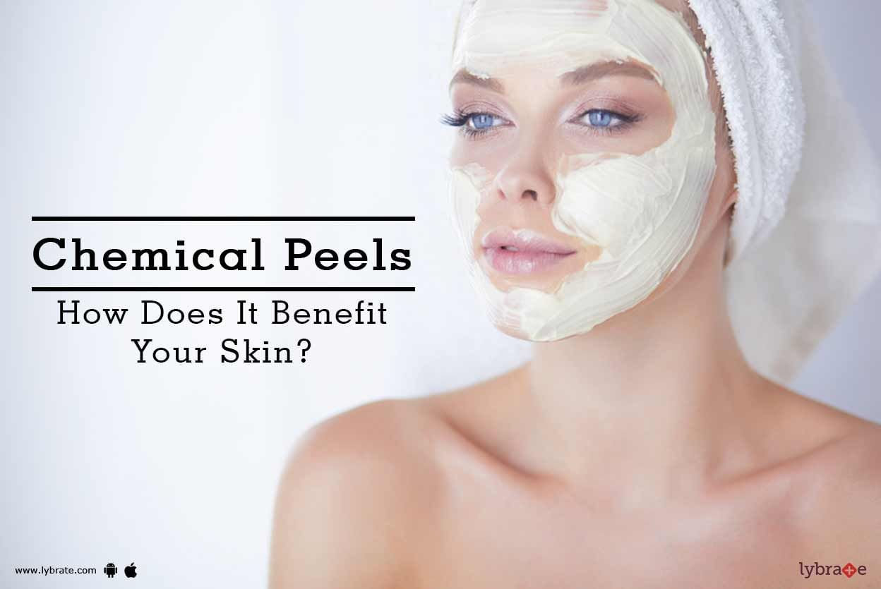 Chemical Peels - How Does It Benefit Your Skin?