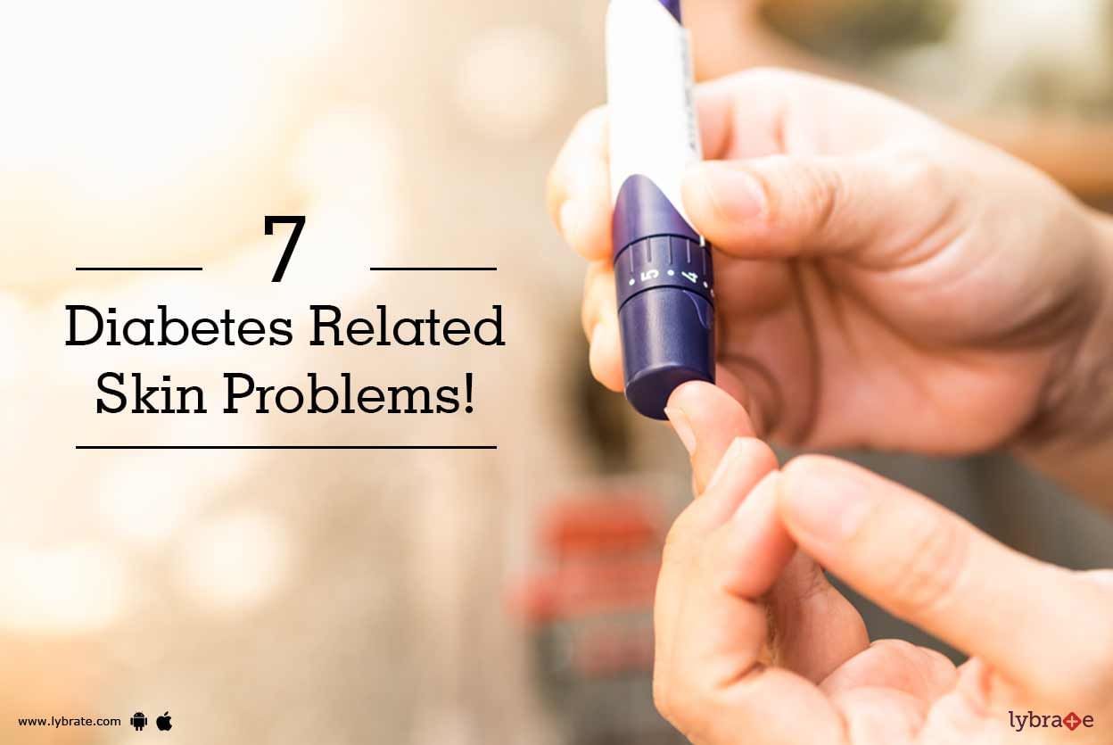 7 Diabetes Related Skin Problems!