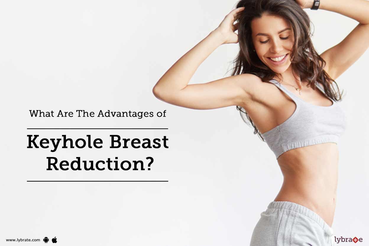 What Are The Advantages of Keyhole Breast Reduction?
