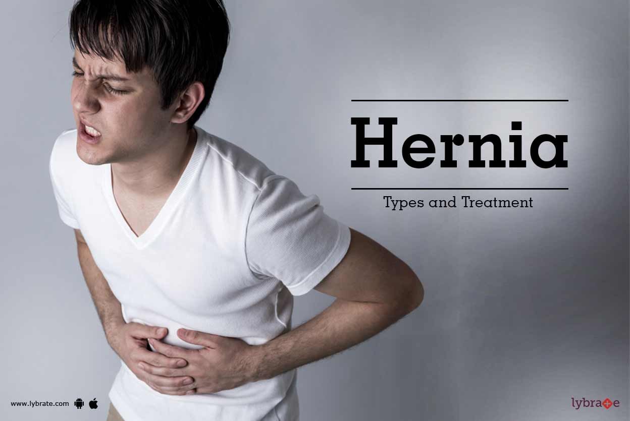 Hernia: Types and Treatment