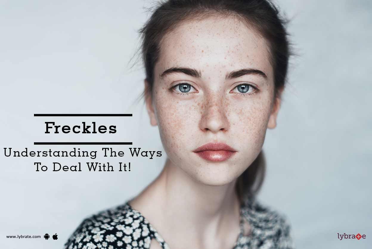 Freckles - Understanding The Ways To Deal With Them!