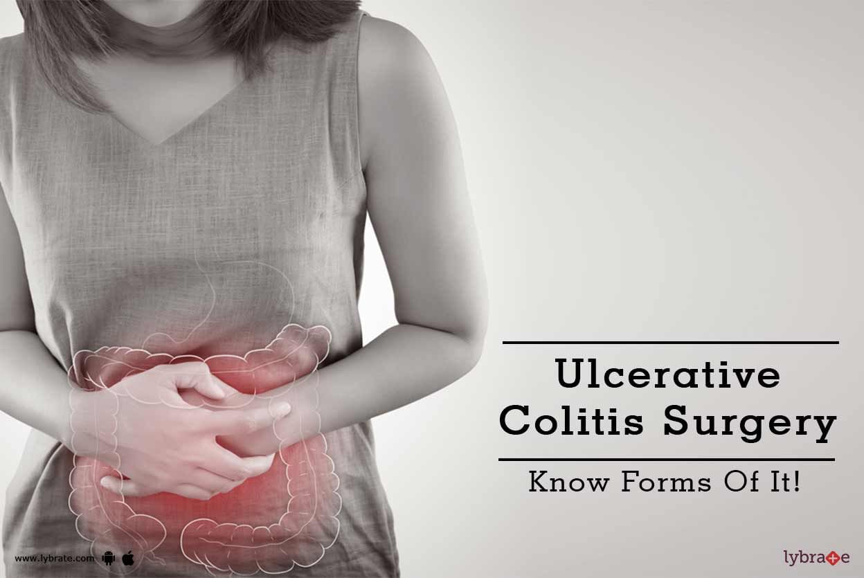 Ulcerative Colitis Surgery - Know Forms Of It!