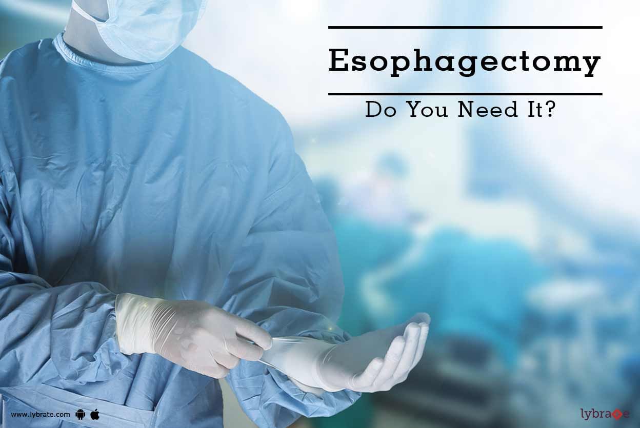 Esophagectomy - Do You Need It?