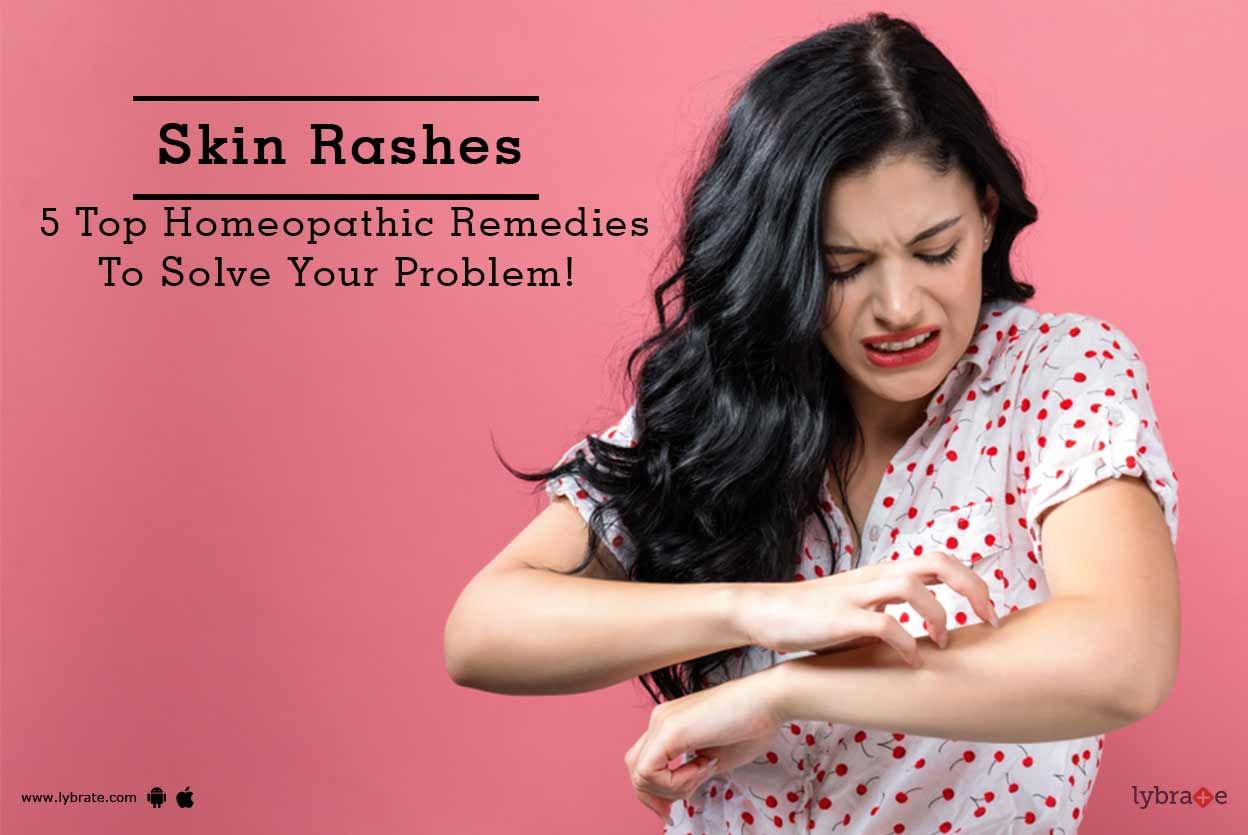 Skin Rashes - 5 Top Homeopathic Remedies To Solve Your Problem!