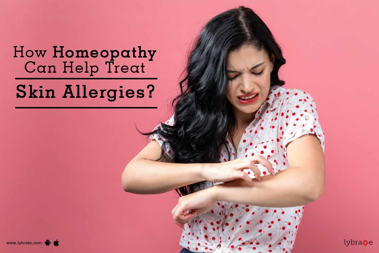 How Homeopathy Can Help Treat Skin Allergies?