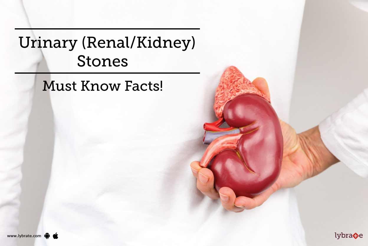 Urinary (Renal/Kidney) Stones - Must Know Facts!
