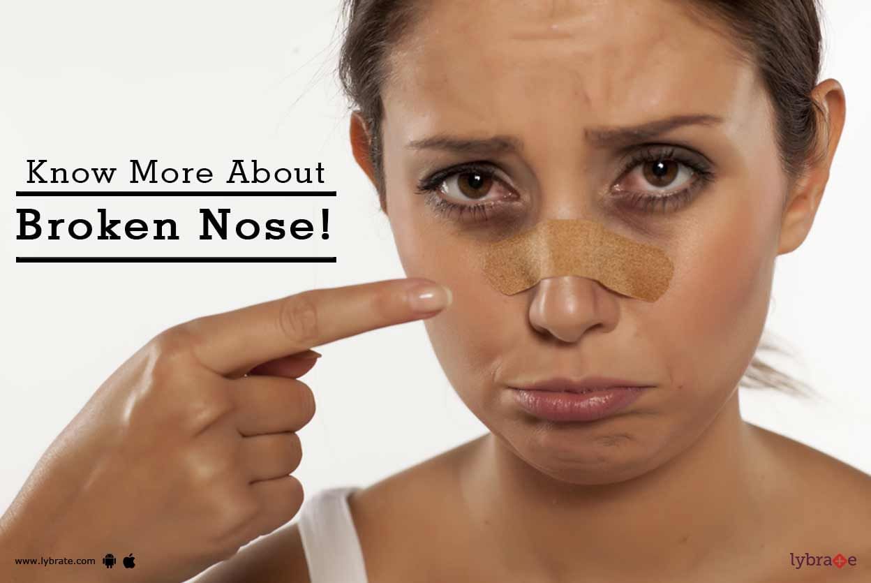 Know More About Broken Nose!