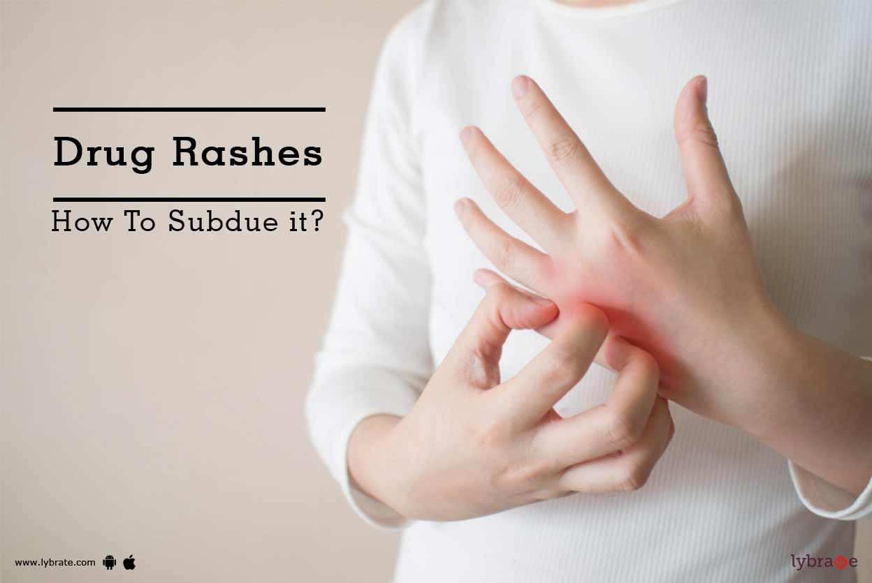 Drug Rashes - How To Subdue it?